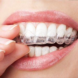 Towson General and Implant Dentistry | Dentures, Periodontal Treatment and Dental Fillings
