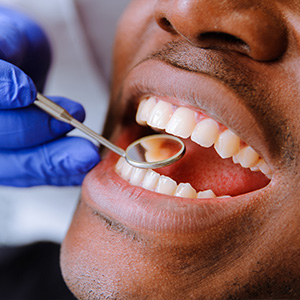 Towson General and Implant Dentistry | Preventative Program, Periodontal Treatment and Oral Exams